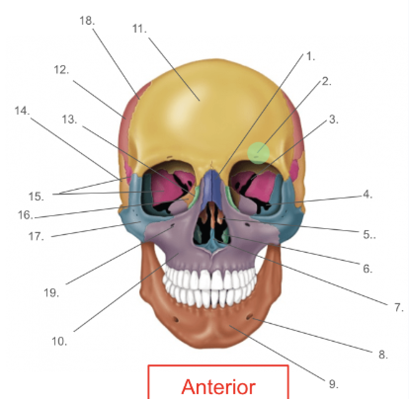 term image