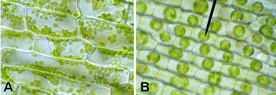 <p><span>Which of the following images represents plasmolyzed plant cells?</span></p>