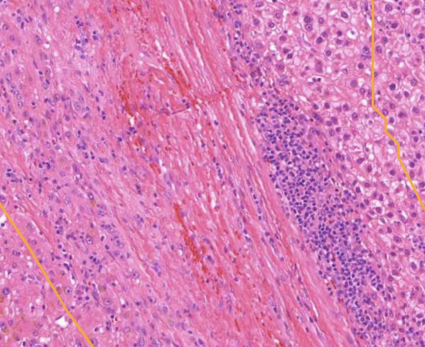 <img src="https://assets.knowt.com/user-attachments/0bf5f3f0-7875-44f2-8994-fa173c7b9212.png" data-width="100%" data-align="center" alt="knowt flashcard image"><p></p>