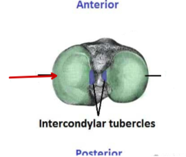 <p>Tibia</p>