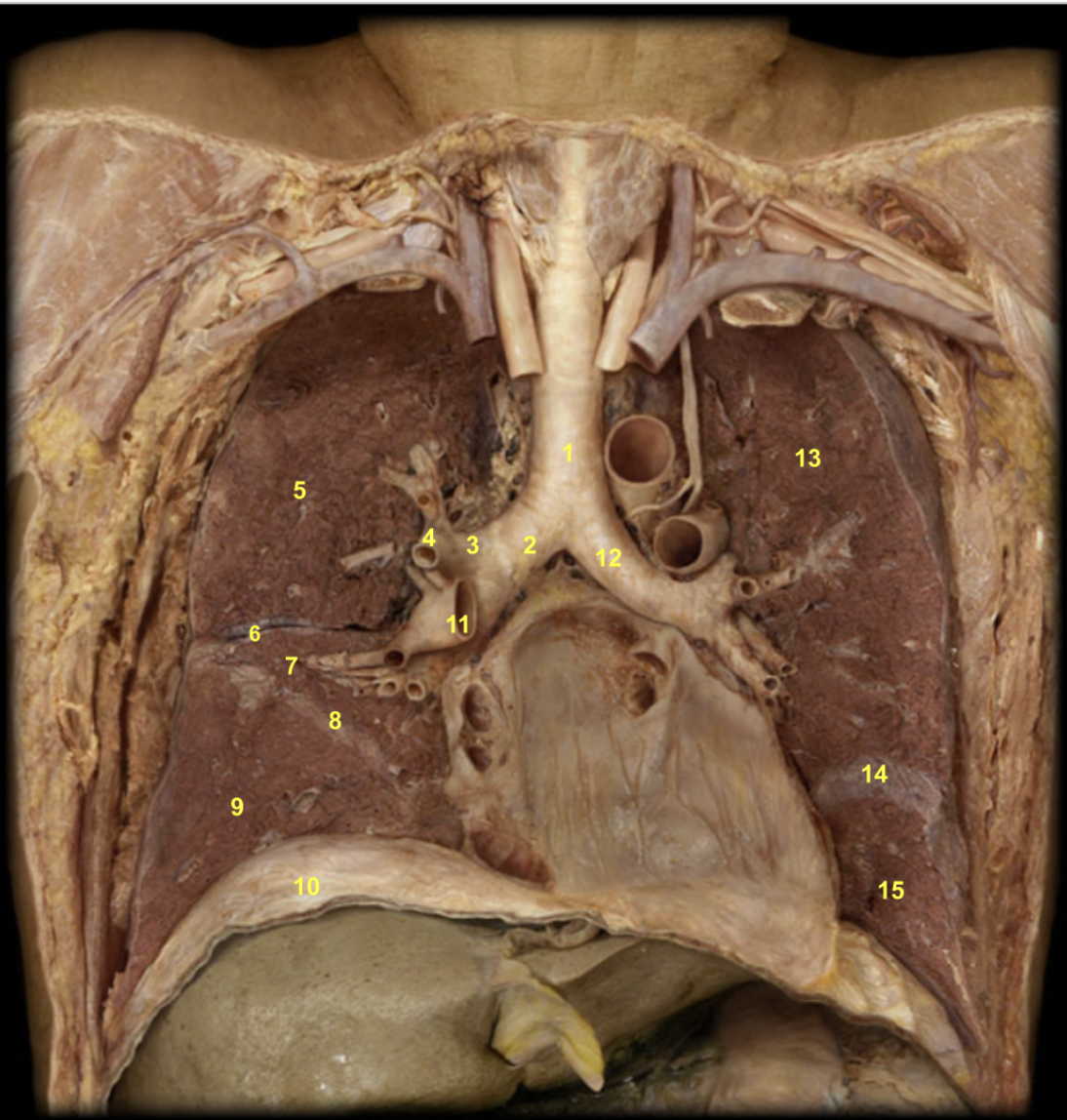 <ol><li><p>Trachea</p></li><li><p>Right main bronchus</p></li><li><p>Right lobar bronchus</p></li><li><p>Right segmental bronchus</p></li><li><p>Superior lobe of right lung</p></li><li><p>Horizontal fissure of right lung</p></li><li><p>Middle lobe of right lung</p></li><li><p>Oblique fissure of right lung</p></li><li><p>Inferior lobe of right lung</p></li><li><p>Diaphragm</p></li><li><p>Right pulmonary artery</p></li><li><p>Left main bronchus</p></li><li><p>Superior lobe of left lung</p></li><li><p>Oblique fissure of left lung</p></li><li><p>Inferior lobe of left lung</p></li></ol><p></p>