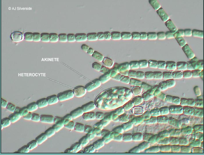 <p>What cyanobacteria is this?</p>
