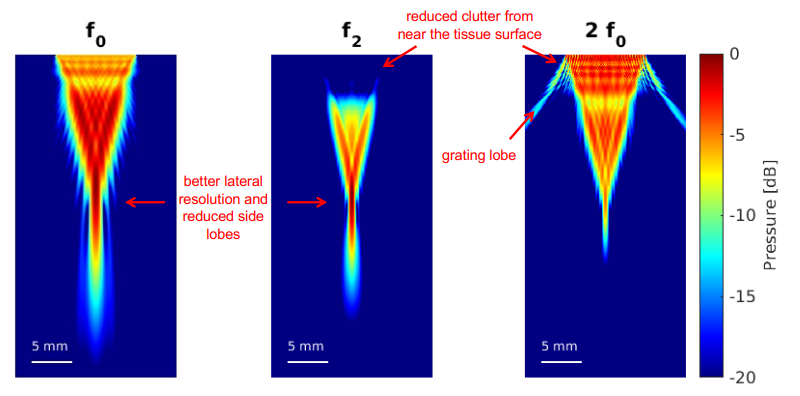 <p>no</p><ol><li><p>increased grating lobe </p></li><li><p>increased clutter and noise at the surface of the tissue </p></li></ol><p></p>