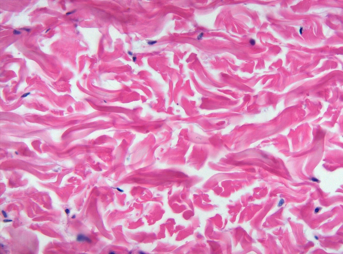 <p><span>Identify the tissue in the micrograph.</span></p>