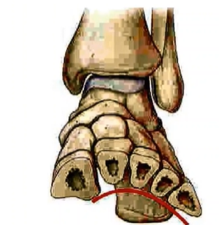 <p>Arch is formed due to wedge-shaped metatarsals, which prevent falling downwards when there is weight/forces from above</p>