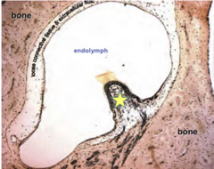 <p>Identify the following structure (YELLOW STAR)</p>