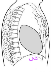 <p>LAO</p>