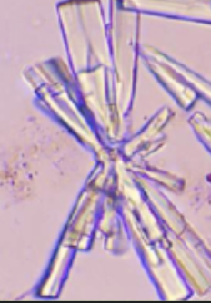 <p>Colorless, flat rectangles/rosettes</p><p>Normal, seen in alkaline urine</p>