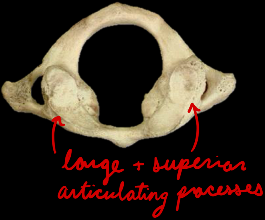 <p>Atlas</p><p>No body</p><p>Large superior articulating processes</p>
