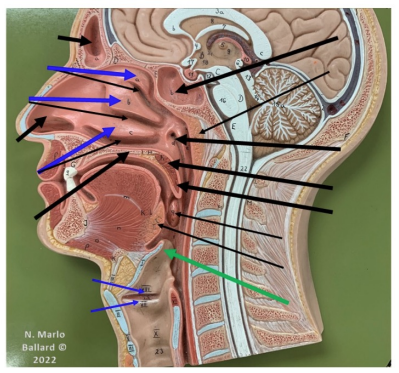 term image