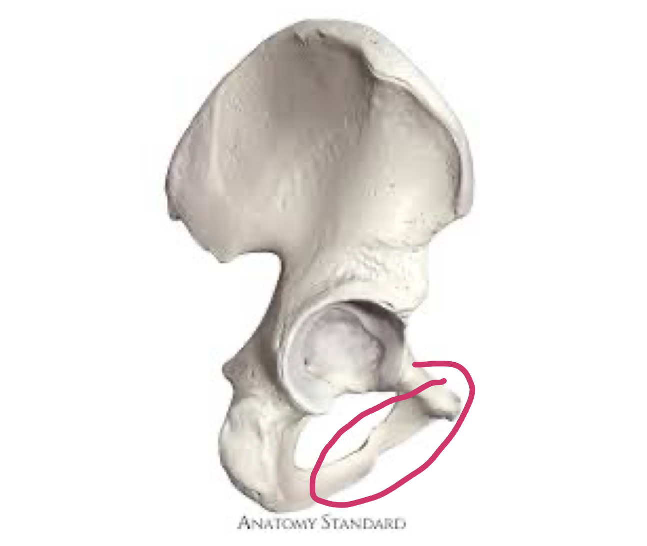 <p>Front part of hip</p>