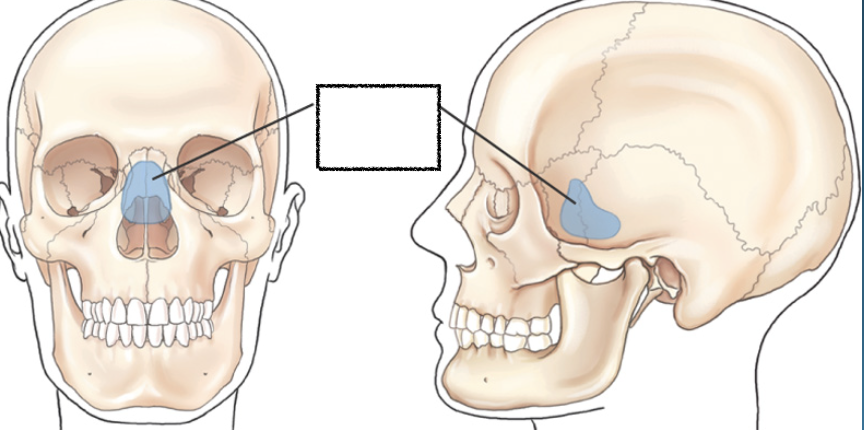 <p>What is this?</p>