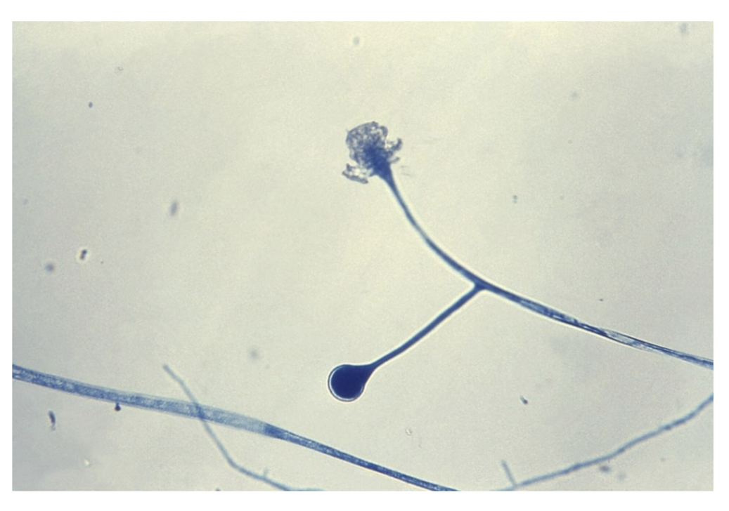<p>-No rhizoids</p><p>-Sporangia fall apart easily</p>