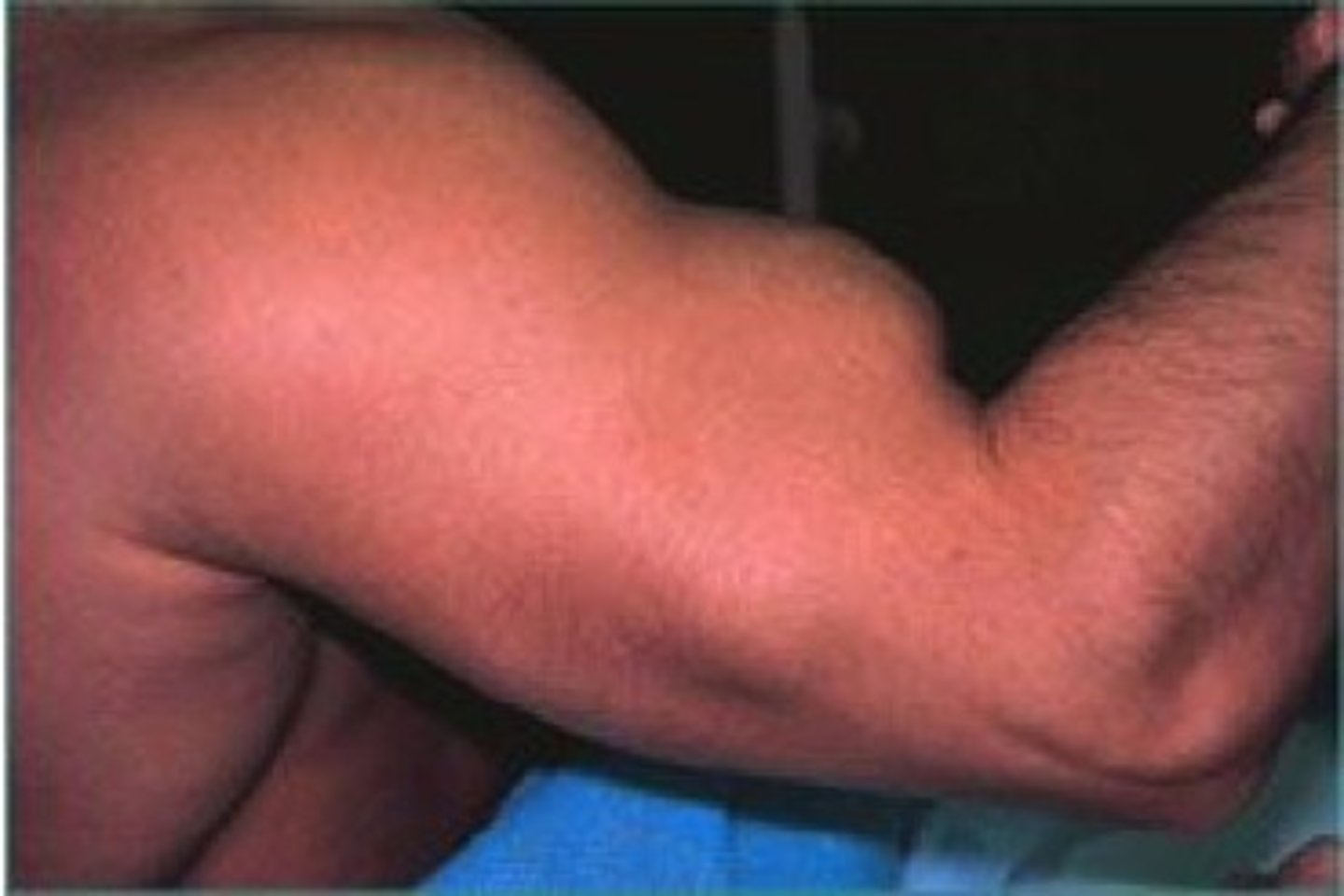 <p>what is this condition?</p>