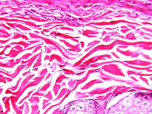 <p>Which is dense <strong>Regular</strong> connective tissue?</p>