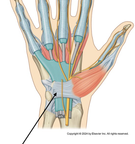 <p>a large, fibrous ligament that stretches over the palmar side of the wrist</p><ul><li><p>connects scaphoid and trapezium laterally with pisiform and hamate medially</p></li><li><p>forms tunnel with carpals through which tendons pass</p></li></ul><p></p>