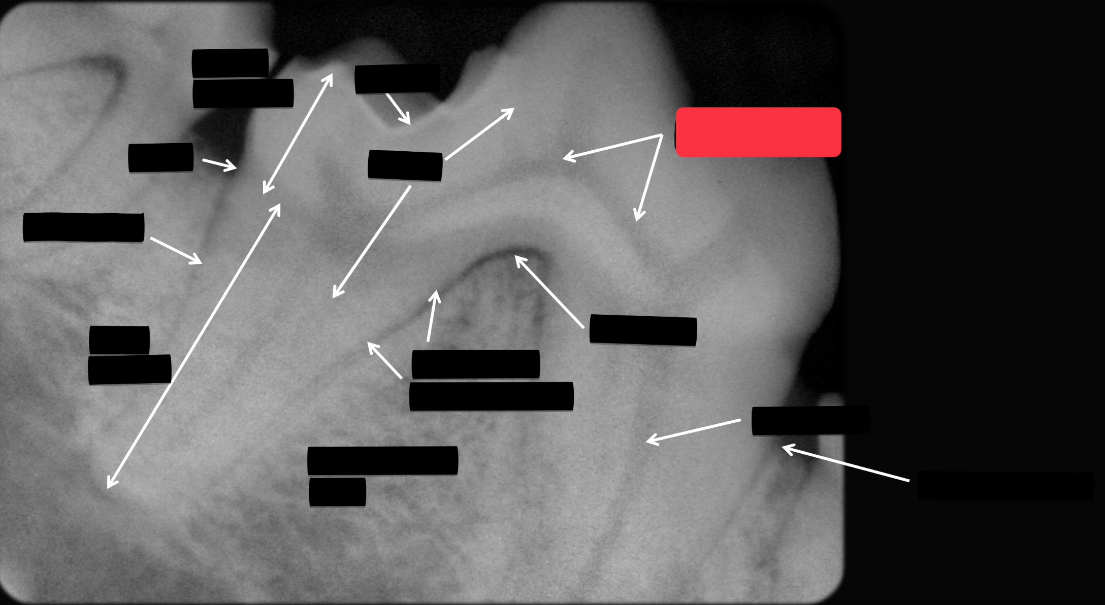 <p>Label this part of the tooth.</p>