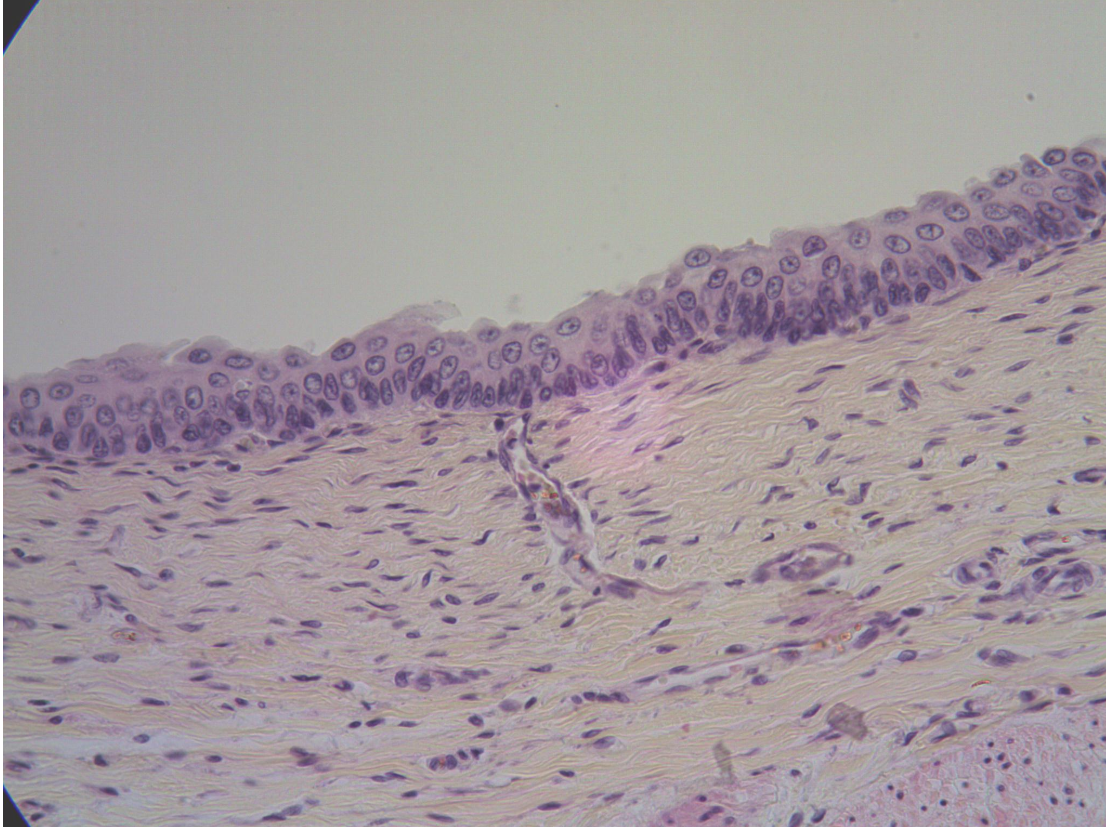 <p>What type of cells are seen lining the lumen in this image</p>