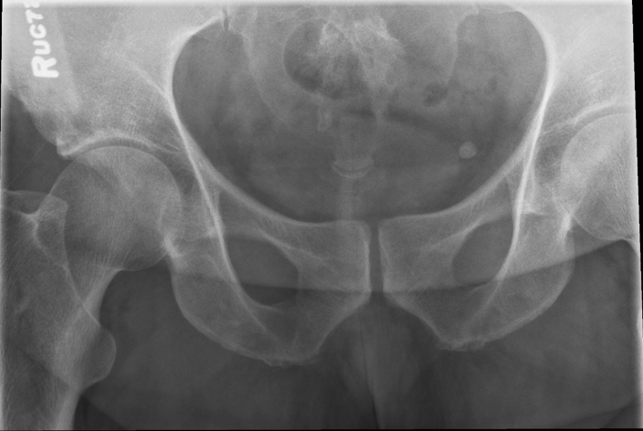 <p>critique this coccyx AP axial</p>