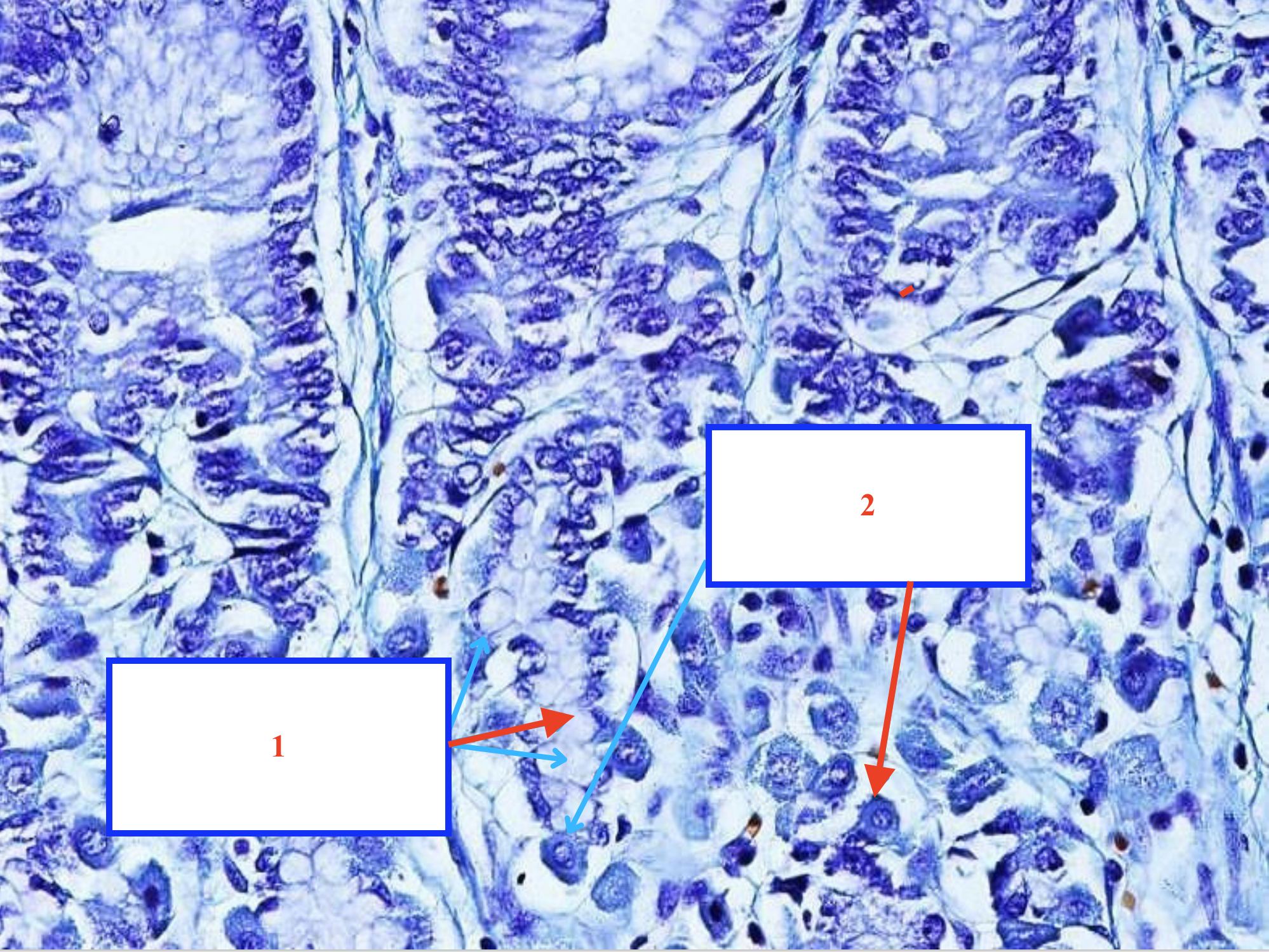 <p>Tế bào gì ?</p>