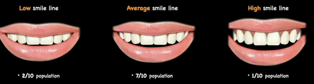 <ol><li><p>average </p></li><li><p>low </p></li><li><p>high</p></li></ol><p></p>
