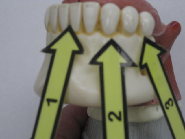 <p>Identify 1, 2 and 3?</p><p>Lab Image 7-7</p>