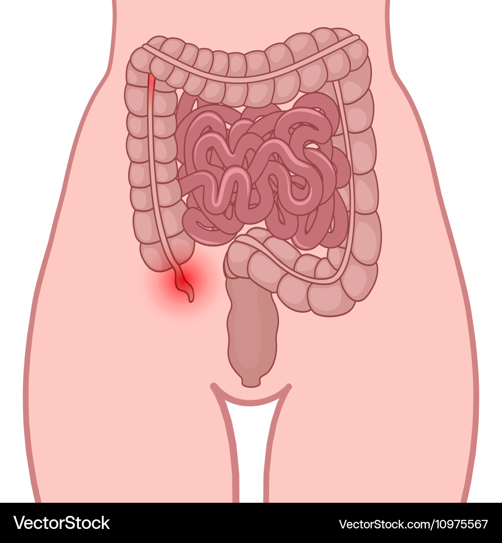 <p>right lower quadrant</p>