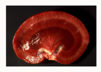 <ul><li><p>single renal lobe</p></li><li><p>single pyramid</p></li><li><p>single papilla</p></li></ul><p></p>