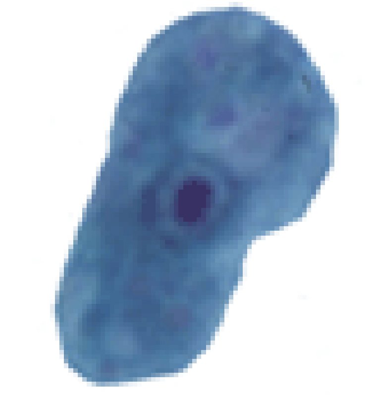 <p>- Sluggish, 8-20 um, large central karyosome</p><p>- Vacuolated, achromatic vacuoles</p>