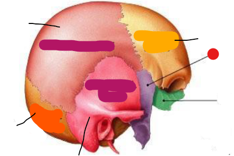 <p>Identify the structure pinned</p>