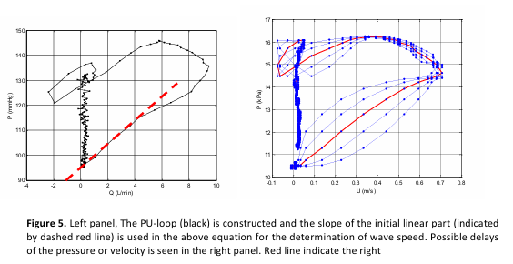 <p>Due to the difference in the frequency response of the equipment used for obtaining the measurements.</p>