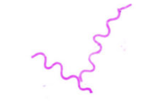 <p>what bacterial shape is this?</p>
