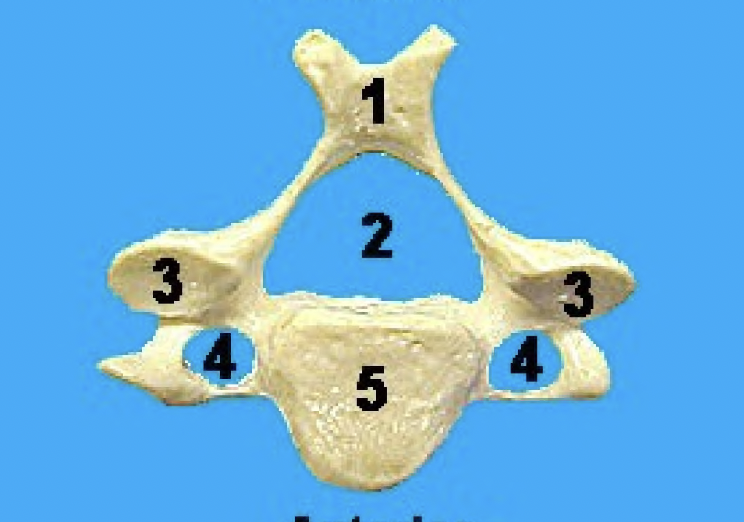 <p>what vertebrae is this and what view</p>