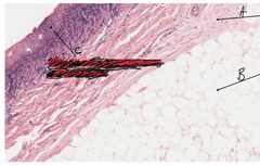 <p>What is indicated by the arrow labeled as 'B' in this slide of a kidney?</p>