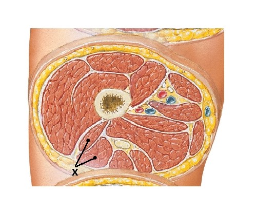 <p><br>What is X? (Thigh)</p>