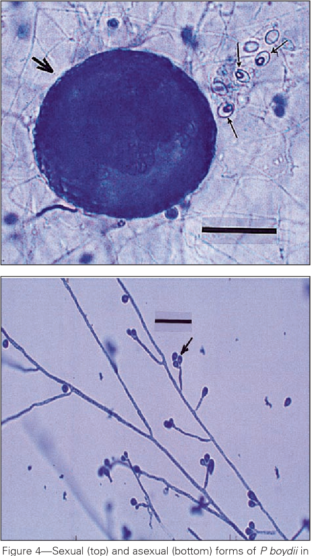 <p>teleomorph form has cleistothecia, anamorph form has elliptoid microconidia</p>