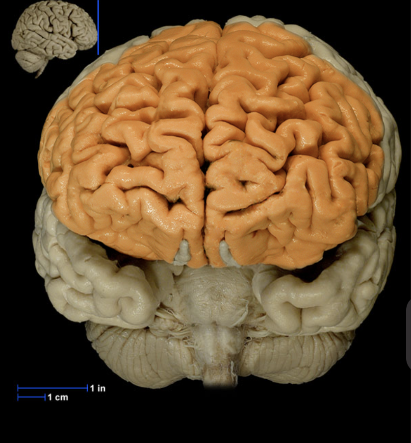 <p>What brain part is this?</p>