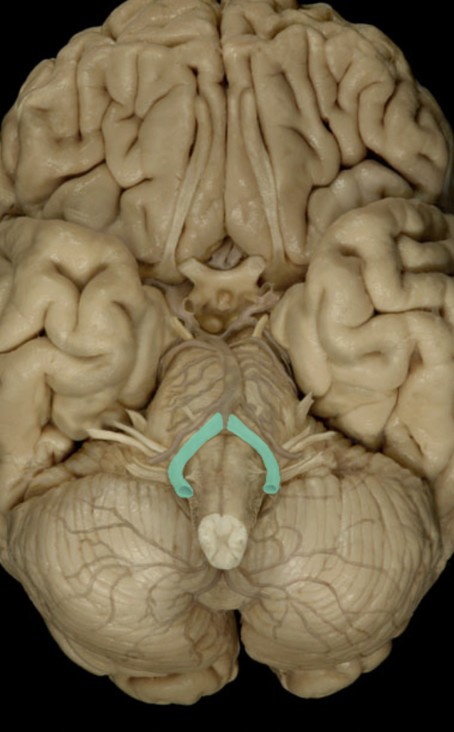 <p>Identify the artery to the brain (circle of willis)</p>
