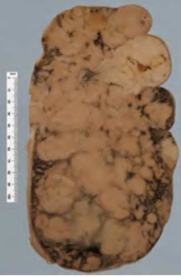 <p>Identify the POT</p>