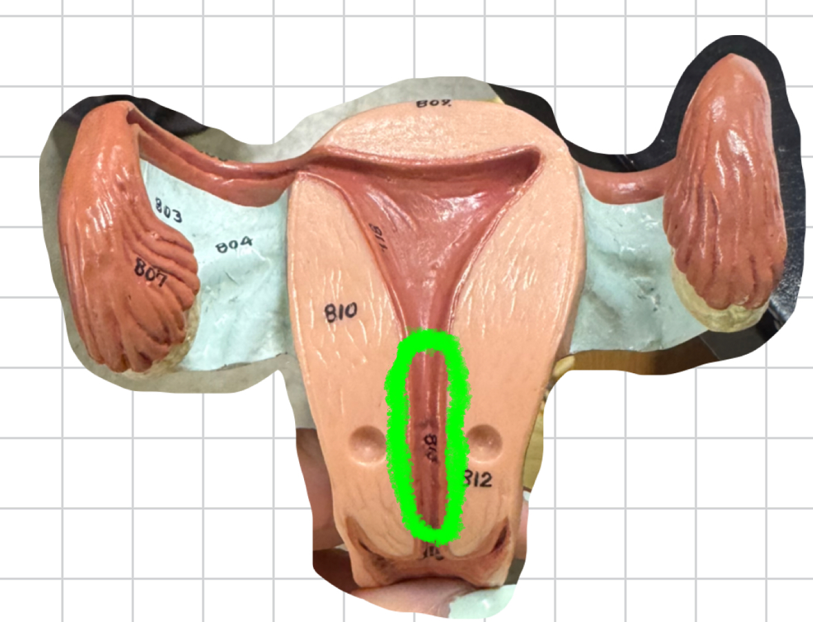 term image