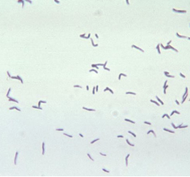 <p>which species of <strong>eubacterium</strong> is best described below:</p><ul><li><p>seagull shape, similar to <strong>campylobacter</strong></p><ul><li><p>found in oral cavity; periodontal disease</p></li></ul></li></ul><p></p>