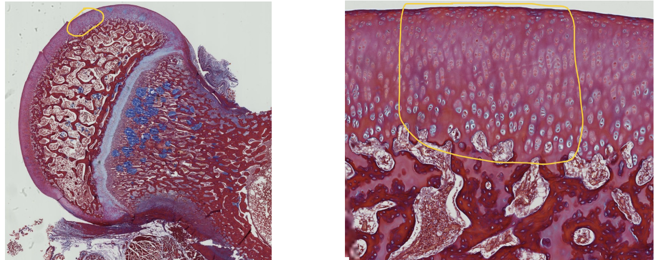 <p>A portion of the articular surface of this long bone is encircled in the left image and is enlarged in the right image.</p><p>1. What do we call this tissue that covers the articulating surfaces of synovial joints?</p><p>2. ID the specific type of CT that makes up this region.</p>