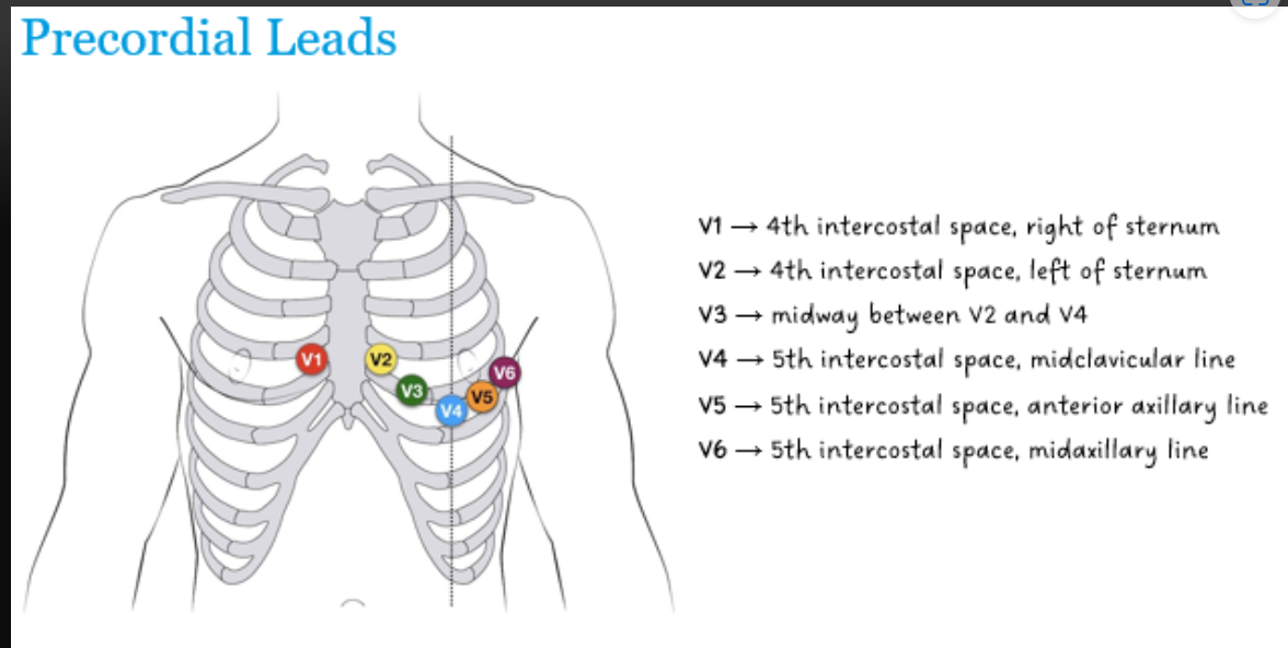 <p>Where is each precordial lead located?</p>