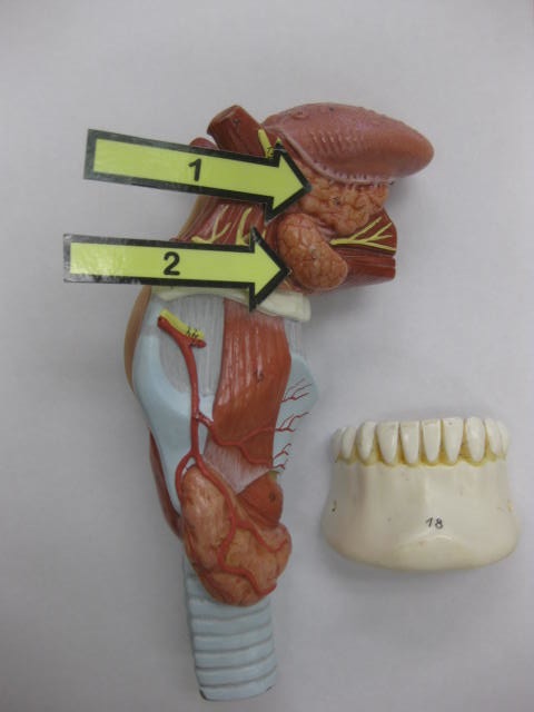 <p>Identify 1 and 2?</p><p>Lab Image 7-5</p>