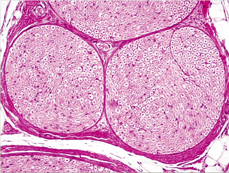 <p>Identifica la plaquita</p>