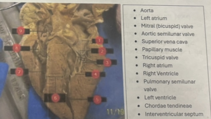 <p>Identify the sheep heart structures labeled 1-9. Use the table bank to guide your answers.</p><p></p>
