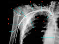 <p>What is labeled 4?</p>