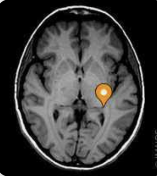 <p>Name the part of the brain, modality, and plane</p>