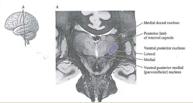 <p><span>Ventral posterior medial nucleus (parvocellular portion). Ascend through internal capsule to next stop</span></p>