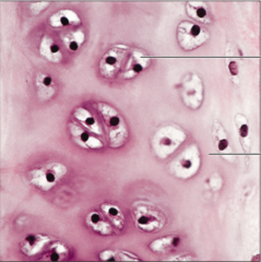 <p>name the tissue: amorphous but firm matrix; collagen fibers form an imperceptible network; chondroblasts produce the matrix and when mature lie in lacunae</p>